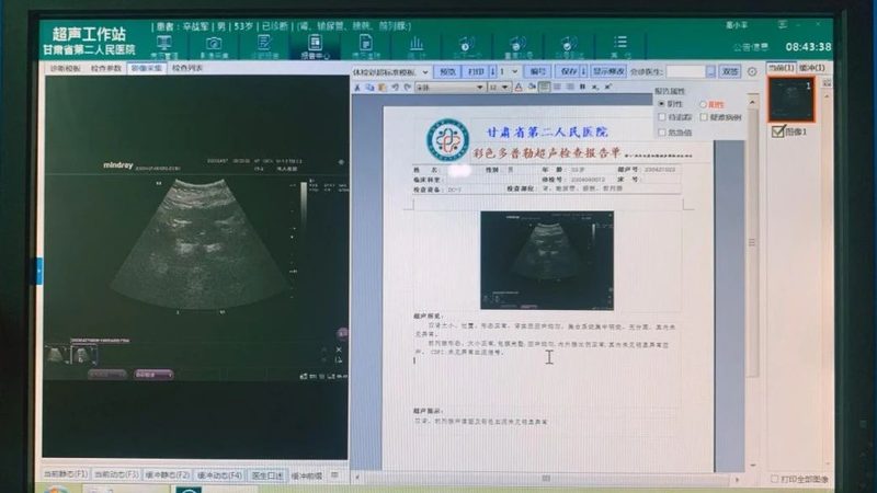上海女性体检中心服务差异解析